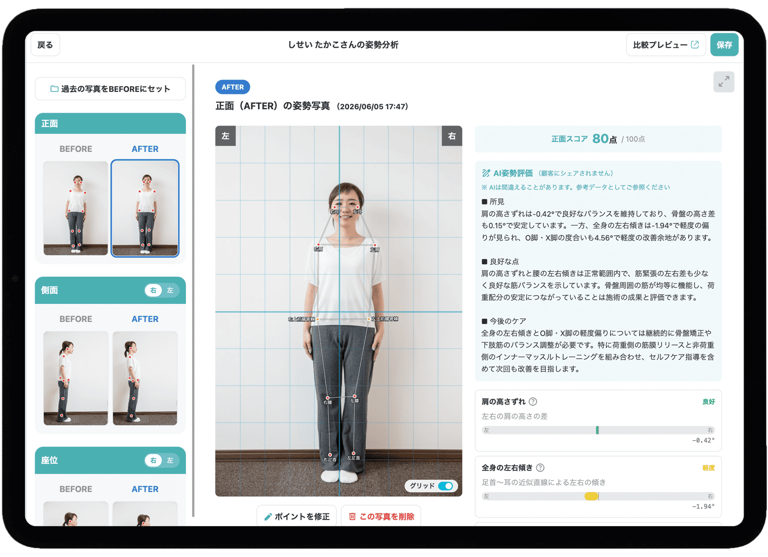 AI姿勢分析で施術の変化が「見える」整骨院へ